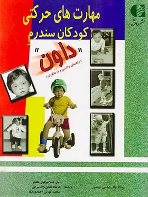 مهارت های حرکتی کودکان سندروم داون